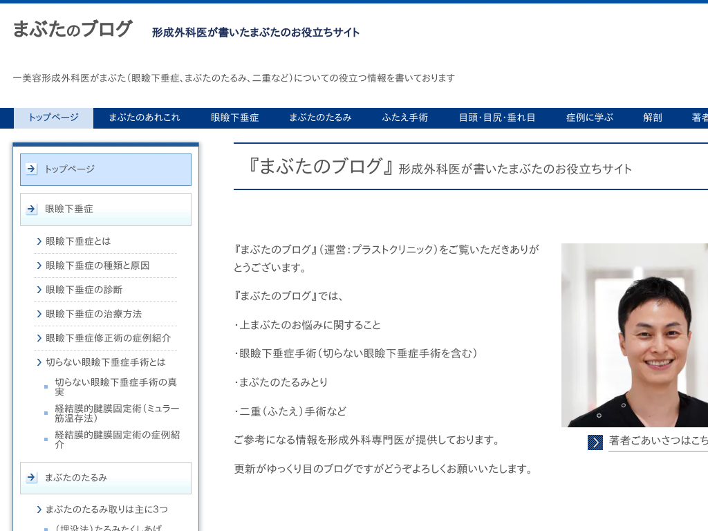 �����s�r���̂܂Ԃ��̃u���O - �`���O�Ȉオ�����܂Ԃ��̂��𗧂��T�C�g