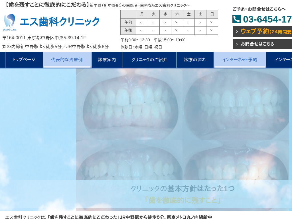 �����s����撆���̃G�X���ȃN���j�b�N